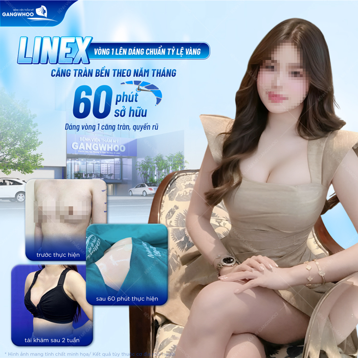 Nâng ngực size 315 là gì? Phù hợp với những ai?