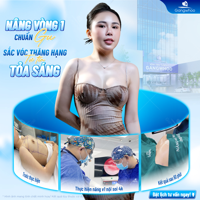 Nâng ngực size bao nhiêu thì đẹp? Hướng dẫn cách chọn size túi nâng