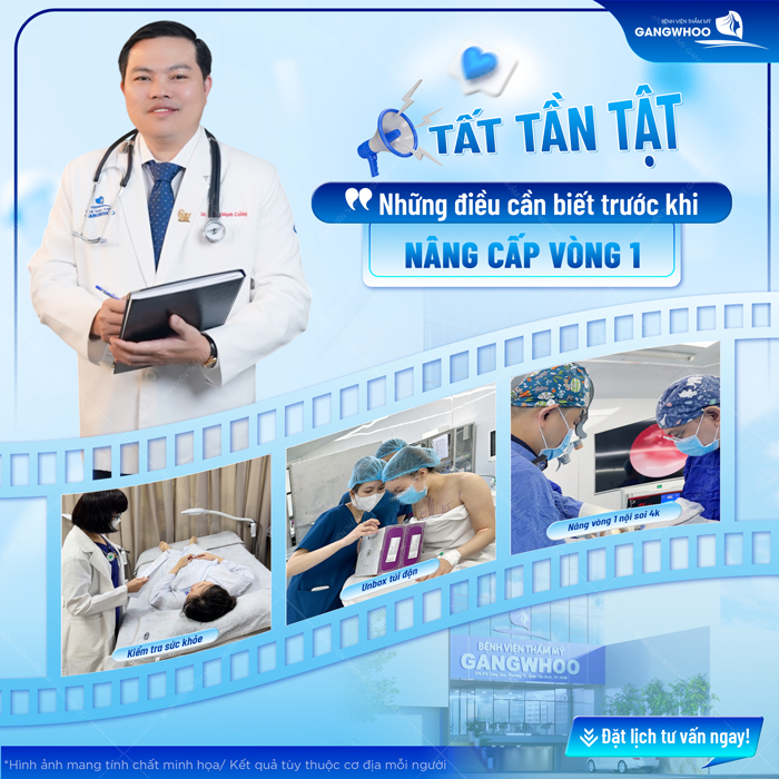 Nâng ngực size bao nhiêu thì đẹp? Hướng dẫn cách chọn size túi nâng