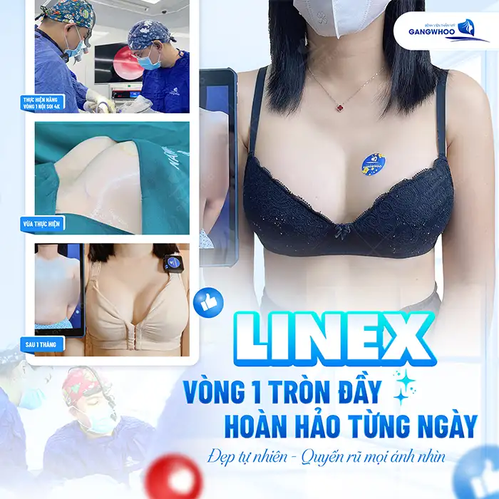 Nâng ngực size nhỏ nhất là bao nhiêu? Những ai phù hợp để nâng size nhỏ