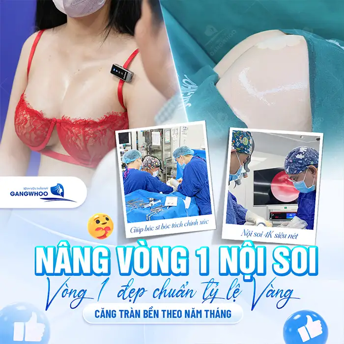 Túi nâng ngực Motiva là gì? Có mấy loại túi nâng ngực Motiva