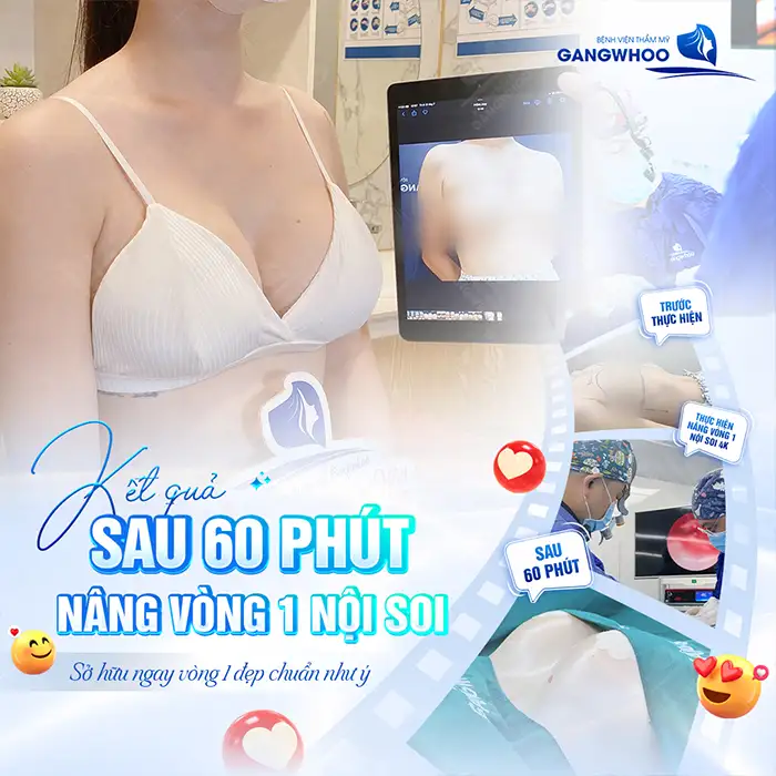 Nâng ngực túi nhám là gì? Nên chọn đặt túi nhám hay túi trơn
