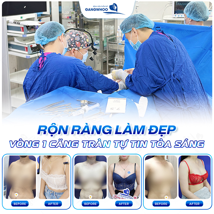 Phẫu thuật nâng ngực mất bao lâu? Nâng ngực đường nào nhanh nhất