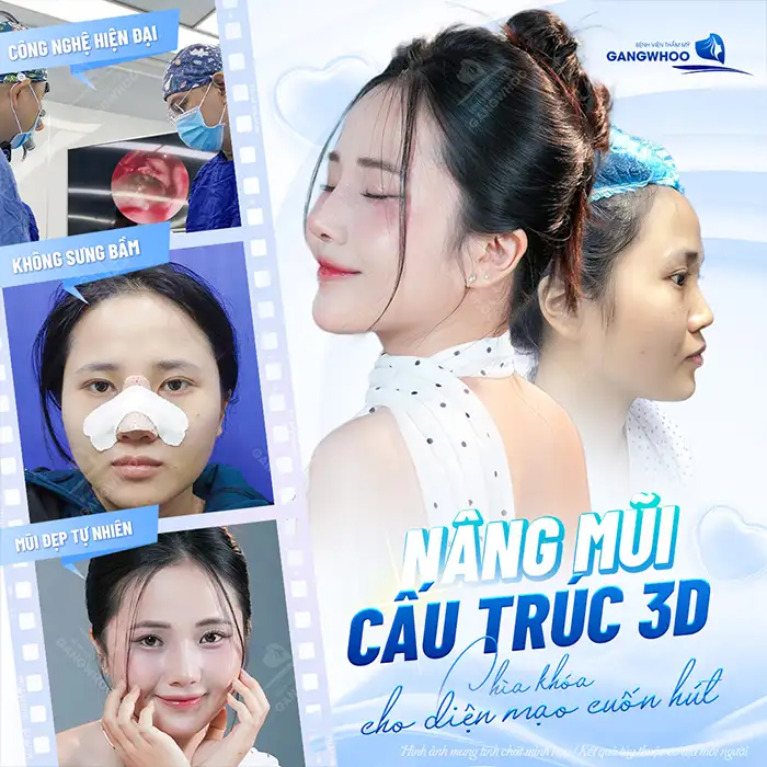 Nâng mũi S Line ở đâu đẹp? 7 địa chỉ uy tín tại TPHCM