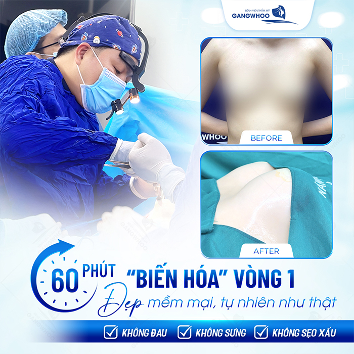 Sau khi nâng ngực bao lâu thì hết đau và sưng? Cách giảm đau hiệu quả