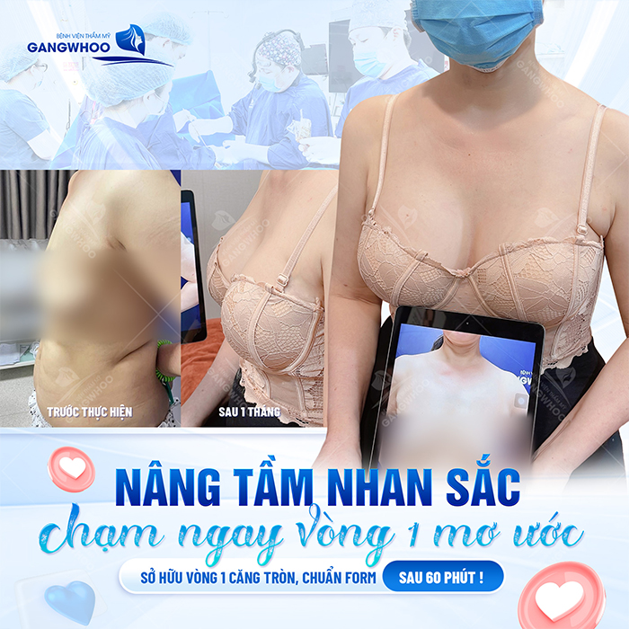 Sau khi nâng ngực bao lâu thì hết đau và sưng? Cách giảm đau hiệu quả