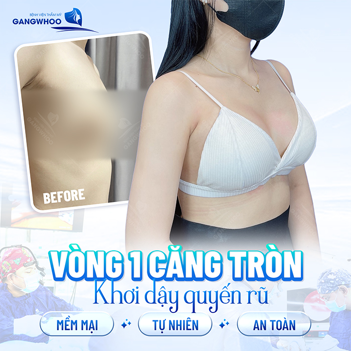 Sẹo nâng ngực là gì? Có mấy loại sẹo và cách hạn chế sẹo khi nâng