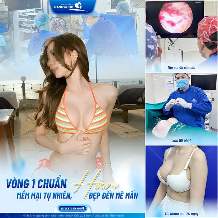 Vì sao cần phải tái khám sau khi nâng ngực? Bao lâu thì tái khám