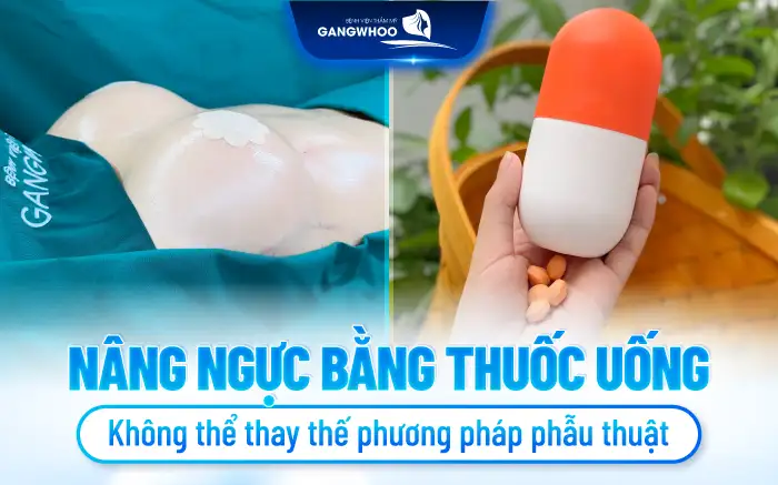 Thuốc nâng ngực là gì? Sữ dụng thuốc nâng ngực có hiệu quả không?