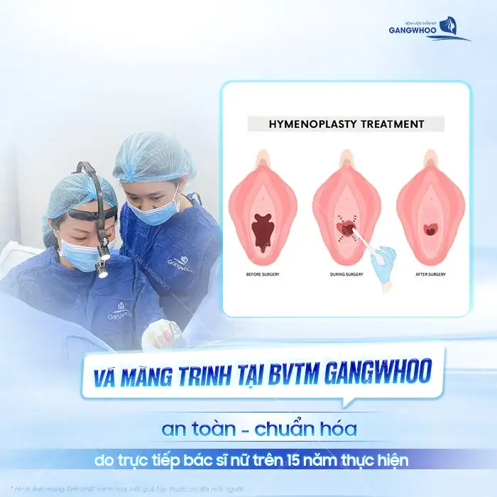 Vá màng trinh bao nhiêu tiền? Cập nhật giá vá màng trinh mới nhất 2025 1 Vá màng trinh bao nhiêu tiền? Cập nhật giá vá màng trinh mới nhất 2025