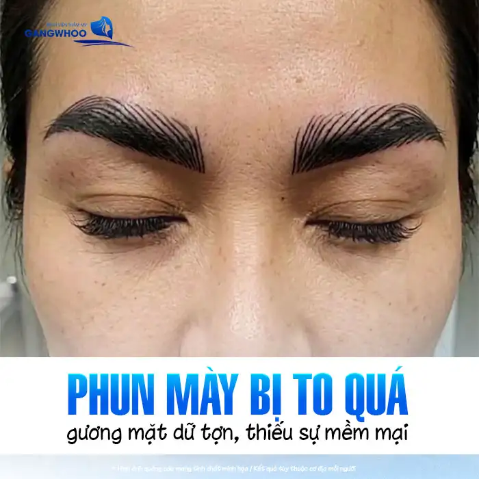 Phun lông mày bị to quá phải làm sao? Nguyên nhân và cách khắc phục