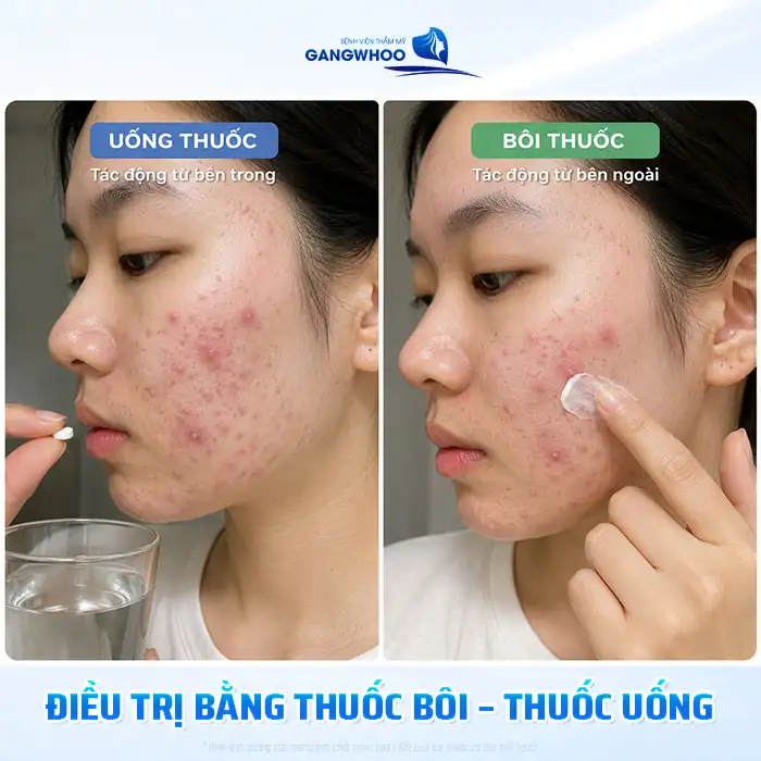 Sử dụng ánh sáng xanh điều trị mụn có tốt không? Lưu ý khi thực hiện