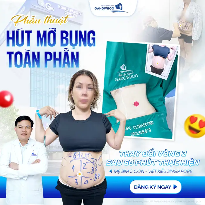 Bác sĩ hút mỡ bụng giỏi ở TP.HCM gồm những ai? Top 5+ bác sĩ uy tín
