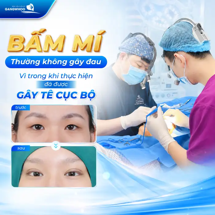 Bấm mí có đau không? Bác sĩ giải đáp cảm giác sau khi bấm mí