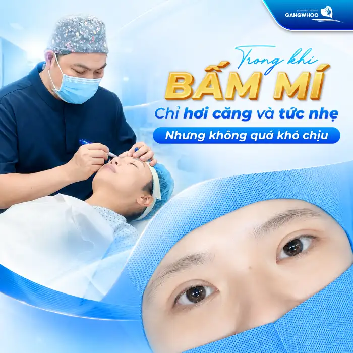 Bấm mí có đau không? Bác sĩ giải đáp cảm giác sau khi bấm mí