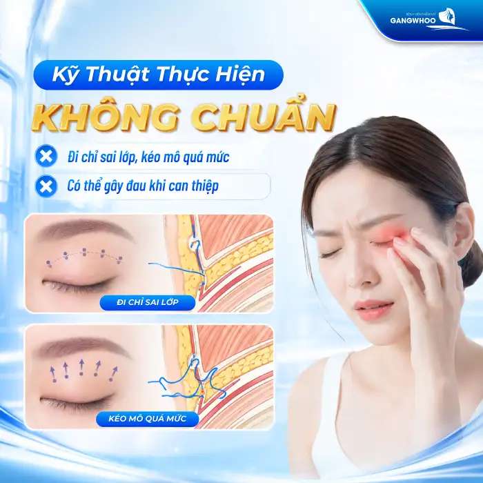 Bấm mí có đau không? Bác sĩ giải đáp cảm giác sau khi bấm mí
