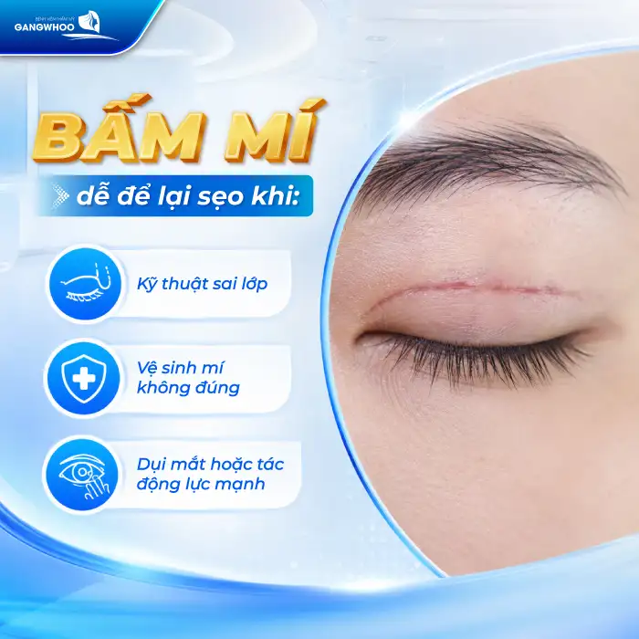 Bấm mí có để lại sẹo không? Cách chăm sóc tránh gây sẹo sau cắt mí