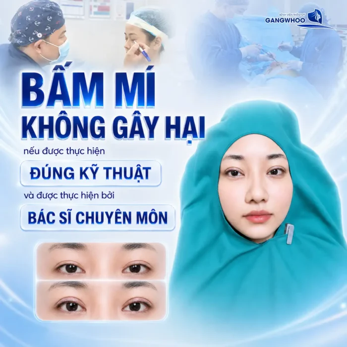 Bấm mí mắt có hại không? Bác sĩ giải đáp rủi ro và độ an toàn