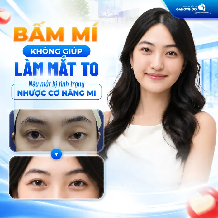 Bấm mí có làm mắt to? Có ảnh hưởng đến dáng mắt không?