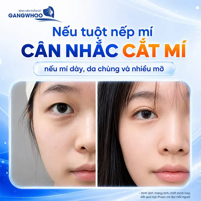 Bấm mí có vĩnh viễn không? Cách duy trì độ bền sau bấm mí