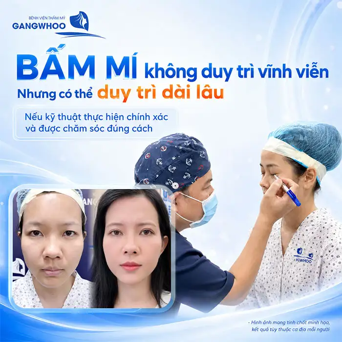 Bấm mí có vĩnh viễn không? Cách duy trì độ bền sau bấm mí
