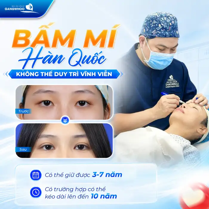 Bấm mí Hàn Quốc có vĩnh viễn? Những yếu tố quyết định đến độ bền