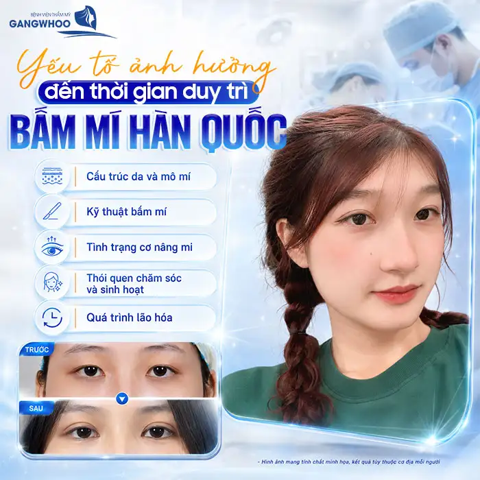 Bấm mí Hàn Quốc được bao lâu? Có giữ được nếp mí lâu dài