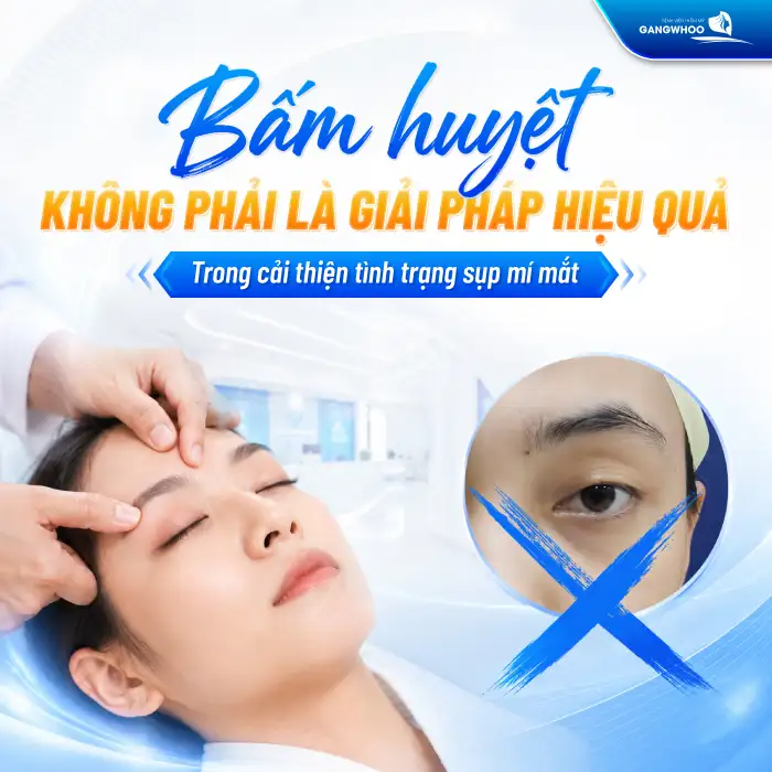 Bấm huyệt chữa sụp mí mắt có hiệu quả không? Thực hư ra sao