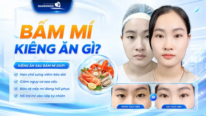 Bấm mí mắt kiêng ăn gì? Chế độ dinh dưỡng giúp nhanh lành