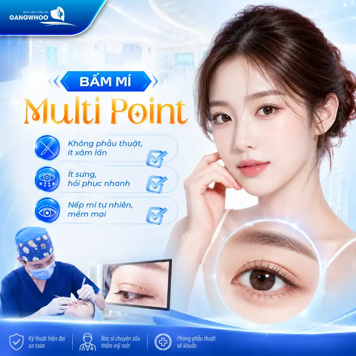 Bấm mí Multi Point là gì? Ưu – nhược điểm của phương pháp