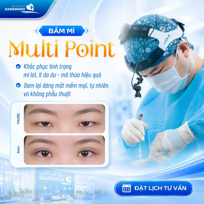 Bấm mí Multi Point là gì? Ưu – nhược điểm của phương pháp