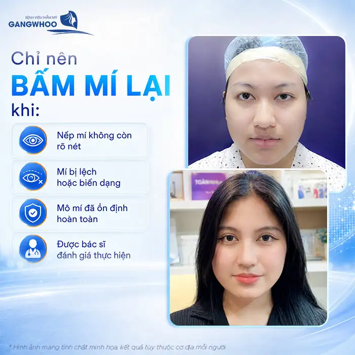 Bấm mí mắt giữ được bao lâu? Cách chăm sóc giữ mí mắt lâu dài