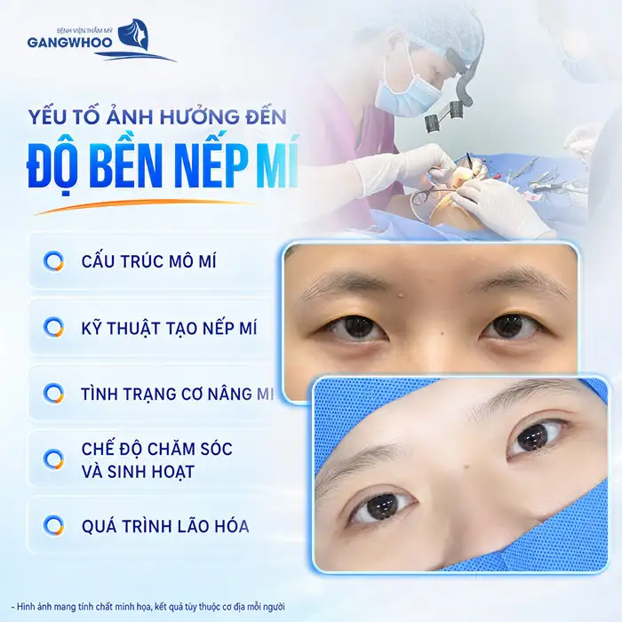 Bấm mí mắt giữ được bao lâu? Cách chăm sóc giữ mí mắt lâu dài