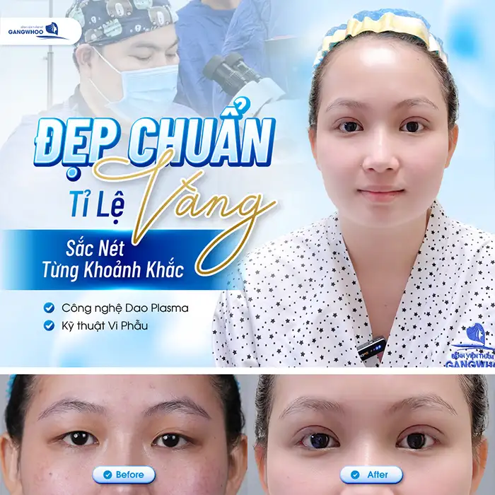 Bao nhiêu tuổi thì cắt mí được? Có nên thực hiện cắt mí sớm