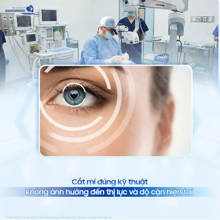 Bị cận có nên cắt mí? Có gây ảnh hưởng đến độ cận không?