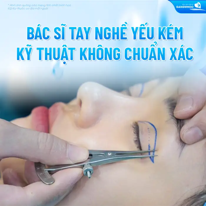 Những biến chứng sau cắt mí có thể gặp là gì? Cách xử lý ra sao?