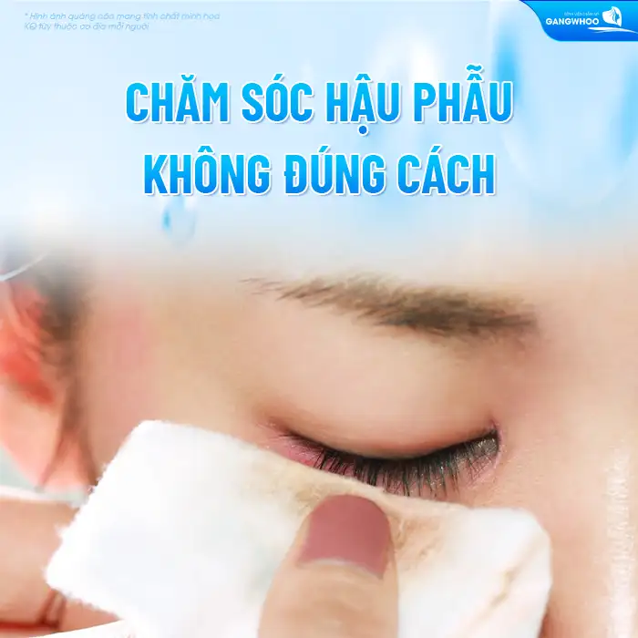 Những biến chứng sau cắt mí có thể gặp là gì? Cách xử lý ra sao?