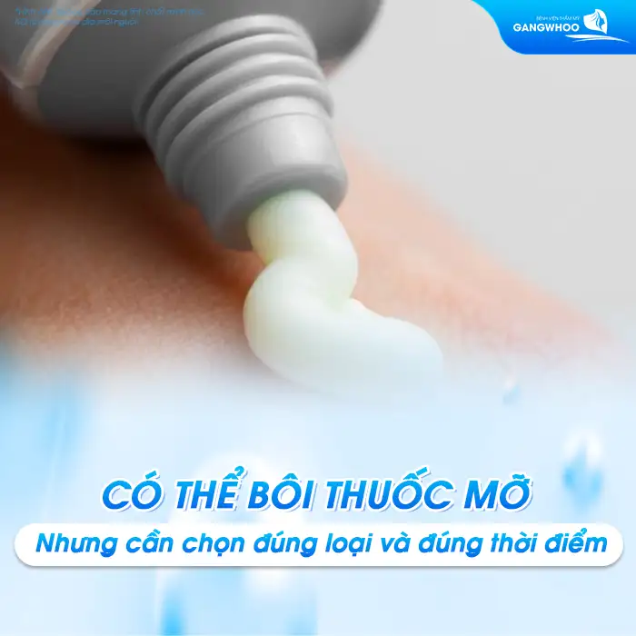 Nên bôi thuốc gì sau khi cắt mí mắt? Cần lưu ý những gì?