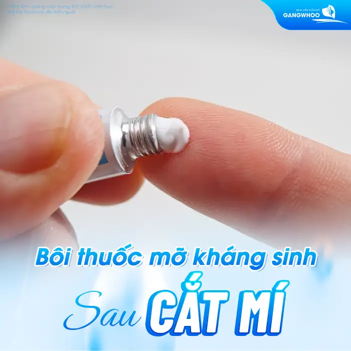 Nên bôi thuốc gì sau khi cắt mí mắt? Cần lưu ý những gì?