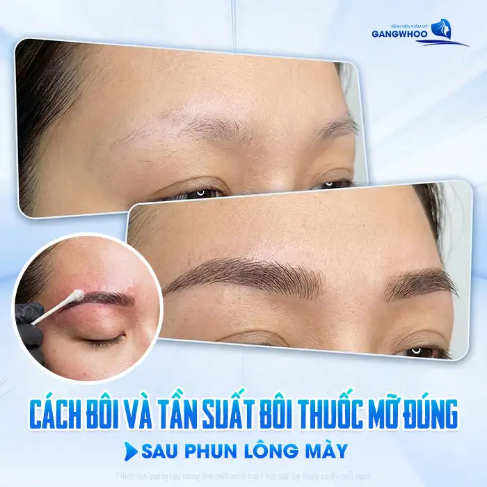 Bôi thuốc mỡ gì sau khi phun lông mày? Thời gian sử dụng bao lâu?