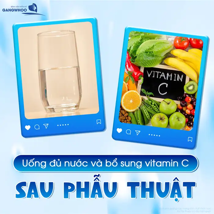 Hướng dẫn cách chườm lạnh sau cắt mí giúp giảm sưng hiệu quả