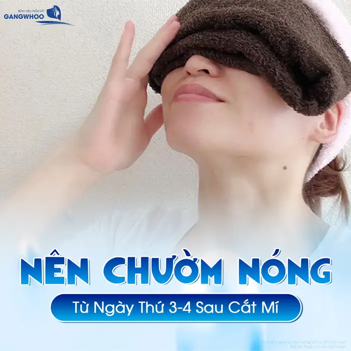 Hướng dẫn cách chườm lạnh sau cắt mí giúp giảm sưng hiệu quả