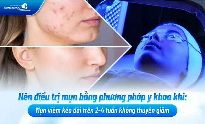 Cách điều trị mụn bằng rau diếp cá tại nhà có hiệu quà không?