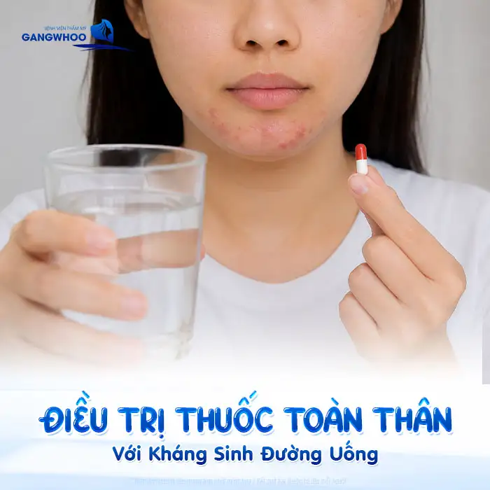 Cách điều trị mụn bọc ở cằm: Giảm sưng nhanh – Ngừa thâm sẹo