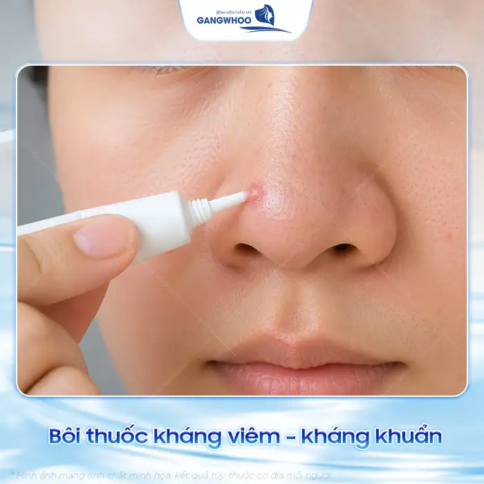 Cách điều trị mụn bọc ở mũi hiệu quả và an toàn, không để lại sẹo
