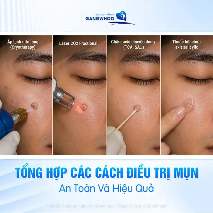 Cách điều trị mụn cóc bằng tỏi có hiệu quả không? Có nên thực hiện?