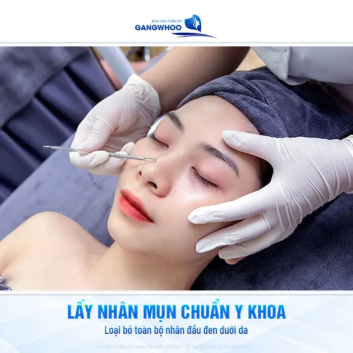 Cách điều trị mụn đầu đen trên mũi an toàn, không làm giãn lỗ chân lông