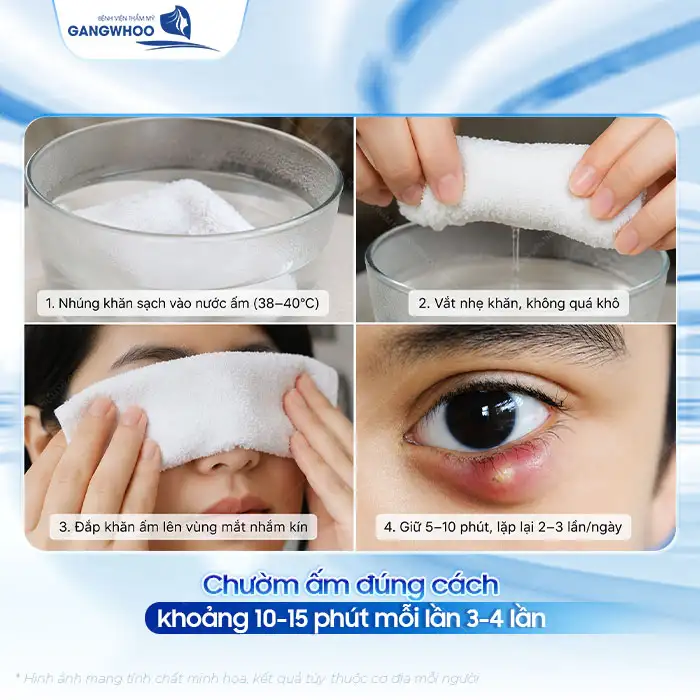 Cách điều trị mụn lẹo ở mắt nhanh khỏi, không tổn thương mí mắt