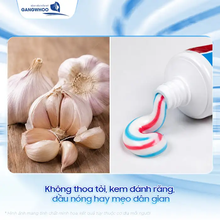 Cách điều trị mụn lẹo ở mắt nhanh khỏi, không tổn thương mí mắt