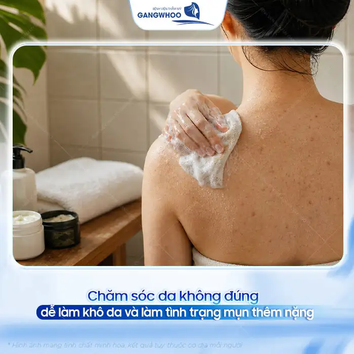 Nguyên nhân gây mụn lưng và cách điều trị mụn lưng hiệu quả